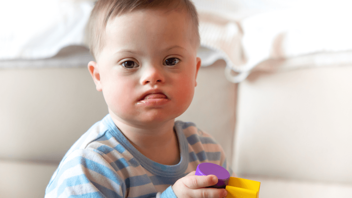 down syndrome image 2